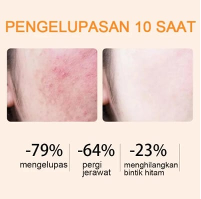 Blizkox™Orange Enzyme Exfoliating Gel — The Gentle Miracle Your Skin Has Been Crying Out For