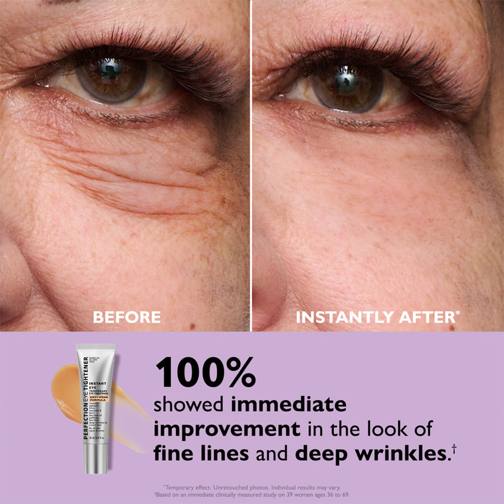 🌸Final Day: 80% OFF🌸 Instant Eye Tightener – Lift, Smooth & Look 10 Years Younger Instantly ✨