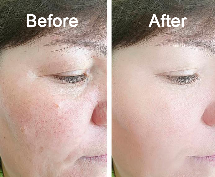 š„š„š„Blizkoxā¢šNatureās Wrinkle Eraser: Macadamia & Peptide Fusion Creamšš„š„š„