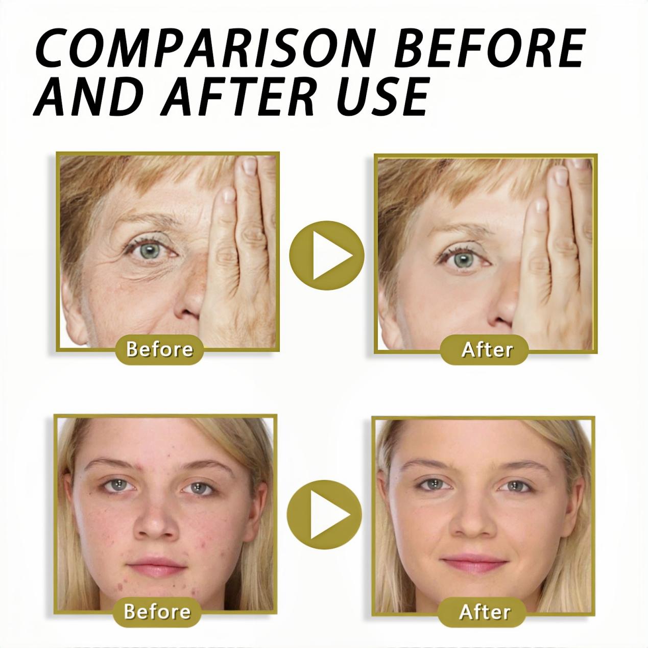 š„š„š„Blizkoxā¢šNatureās Wrinkle Eraser: Macadamia & Peptide Fusion Creamšš„š„š„