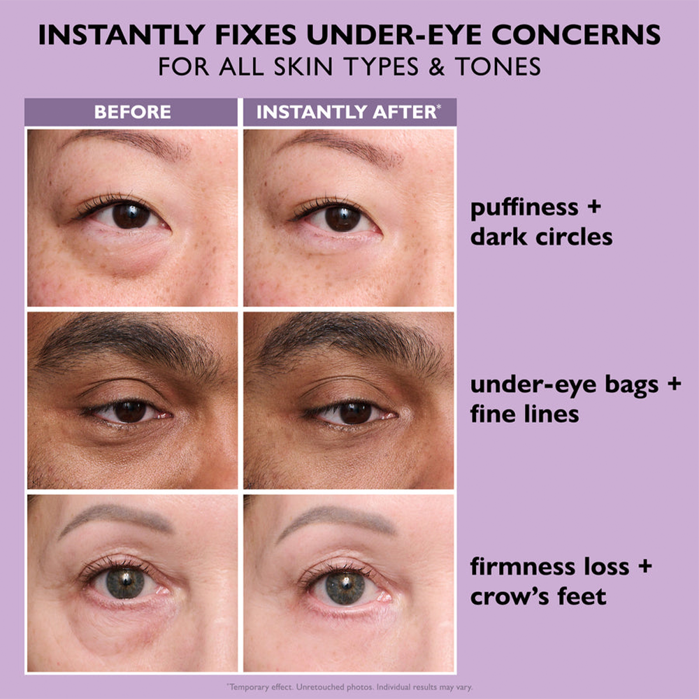 🌸Final Day: 80% OFF🌸 Instant Eye Tightener – Lift, Smooth & Look 10 Years Younger Instantly ✨