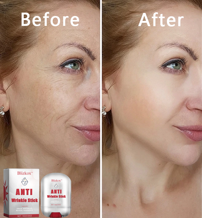 š„š„š„Blizkoxā¢AMTI Wrinkle Stick-nti-aging starts here. A mysterious power waiting for you to discover.šš„š„š„