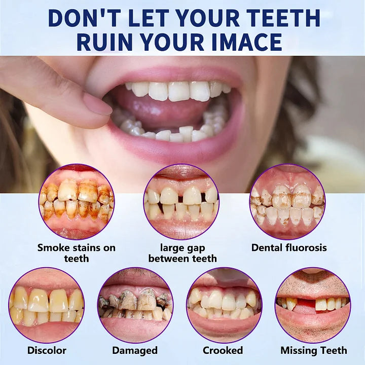 Blizkox™-🦷Advanced Customized Full Denture Set – For a Perfect Smile and Natural Comfort🥰( 🔥Last Day Promotion🔥）