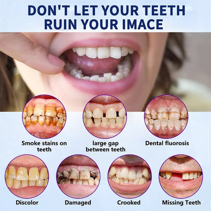 Blizkox™-🦷Advanced Customized Full Denture Set – For a Perfect Smile and Natural Comfort🥰( 🔥Last Day Promotion🔥）