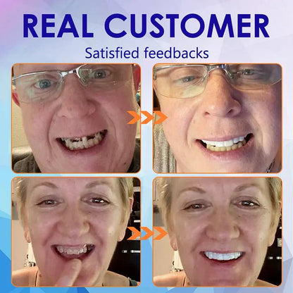 Blizkox™-🦷Advanced Customized Full Denture Set – For a Perfect Smile and Natural Comfort🥰( 🔥Last Day Promotion🔥）