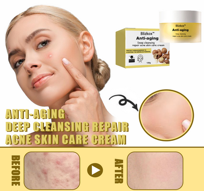 🔥🔥🔥Blizkox™🛒Nature’s Wrinkle Eraser: Macadamia & Peptide Fusion Cream🛒🔥🔥🔥