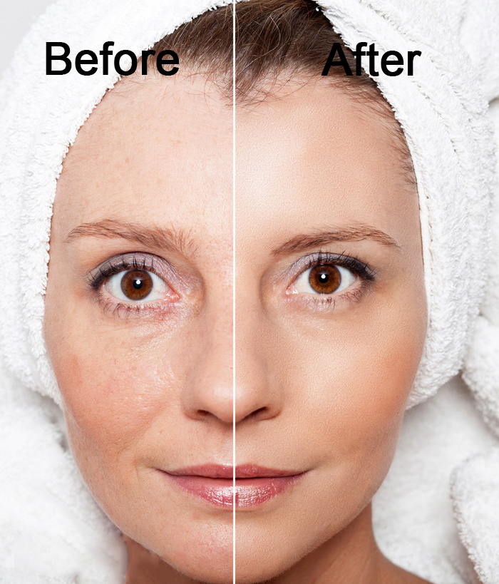 🔥🔥🔥Blizkox™🛒Nature’s Wrinkle Eraser: Macadamia & Peptide Fusion Cream🛒🔥🔥🔥