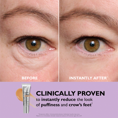 🌸Final Day: 80% OFF🌸 Instant Eye Tightener – Lift, Smooth & Look 10 Years Younger Instantly ✨