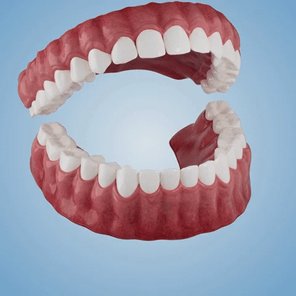 Blizkox™-🦷Advanced Customized Full Denture Set – For a Perfect Smile and Natural Comfort🥰( 🔥Last Day Promotion🔥）