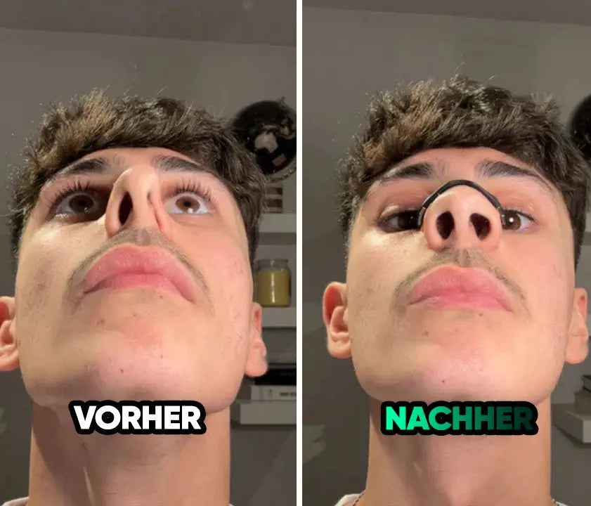 Magnetic Nose Patch – Breathing Expander Keeping You Breathing, Naturally.（副本）