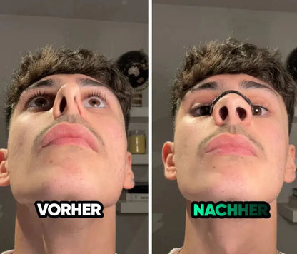 Magnetic Nose Patch – Breathing Expander Keeping You Breathing, Naturally.（副本）