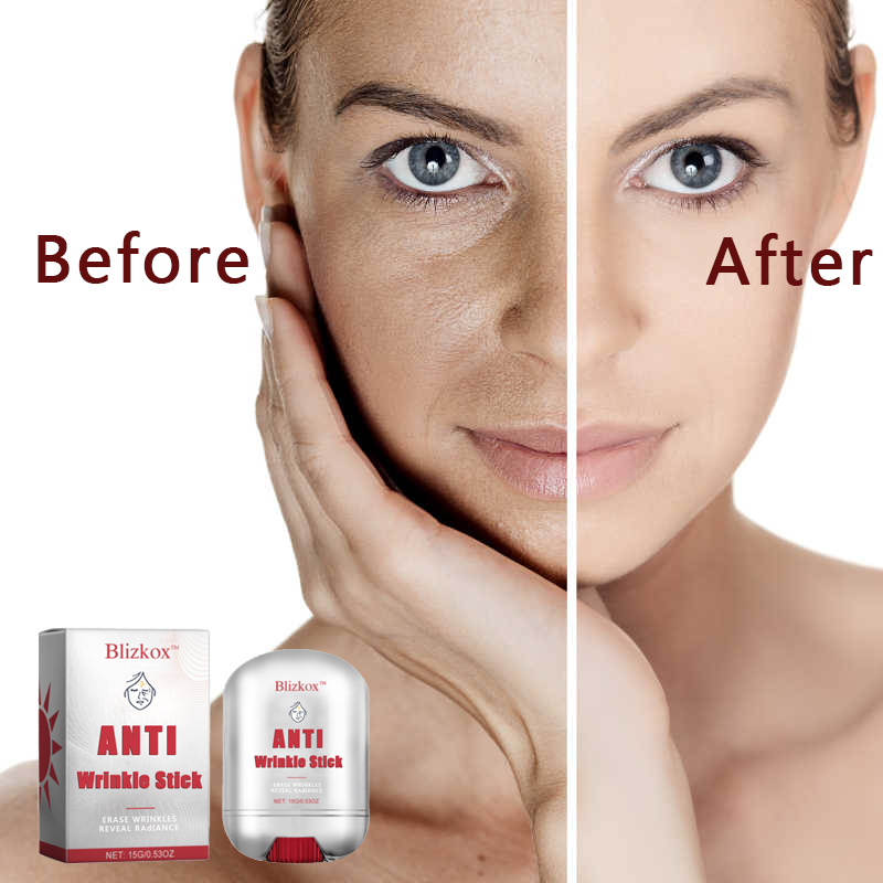 🔥🔥🔥Blizkox™AMTI Wrinkle Stick-nti-aging starts here. A mysterious power waiting for you to discover.🛒🔥🔥🔥